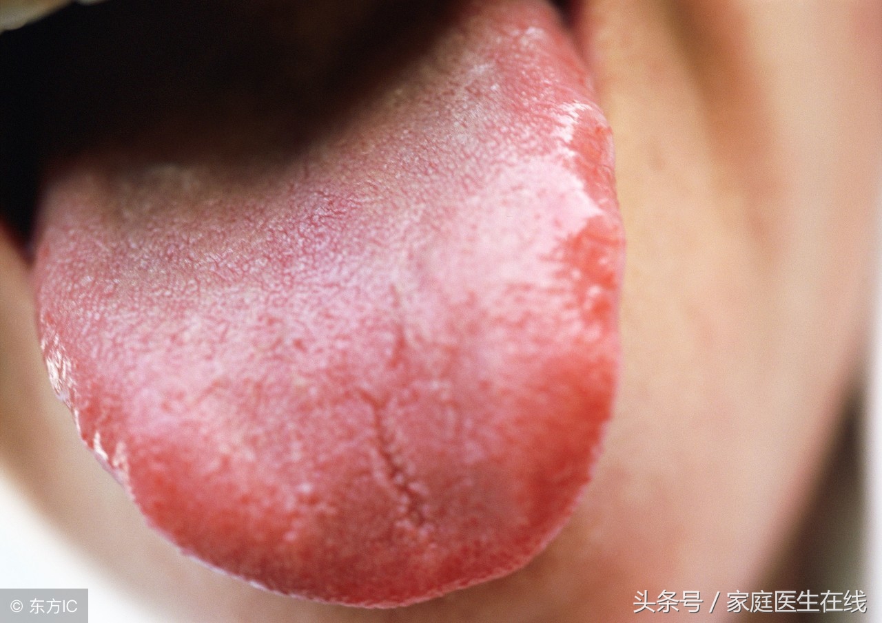 注意：这个部位有臭味，是肝脏上火的“证明”