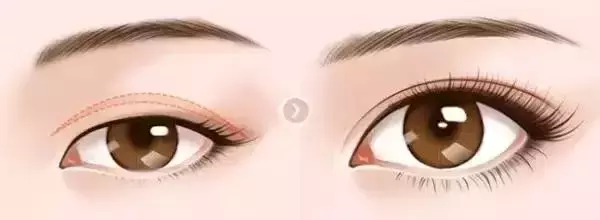 上海九院眼整形大咖4月29日空降郑州普瑞眼科医院！美眼就现在！