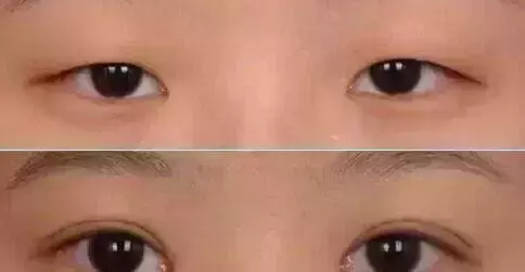 上海九院眼整形大咖4月29日空降郑州普瑞眼科医院！美眼就现在！