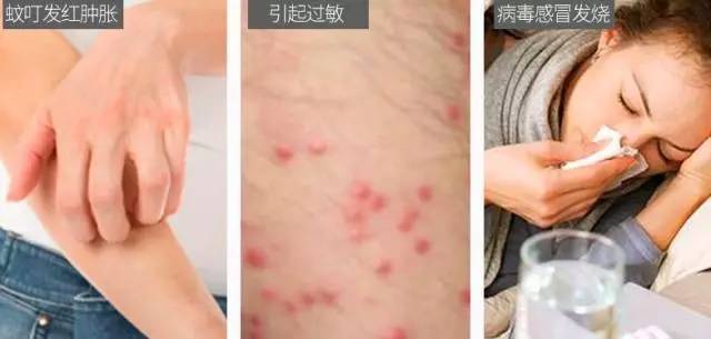 蚊虫终结者~悬浮磁吸、双重引诱灭蚊神器,对孕妇、儿童都安全