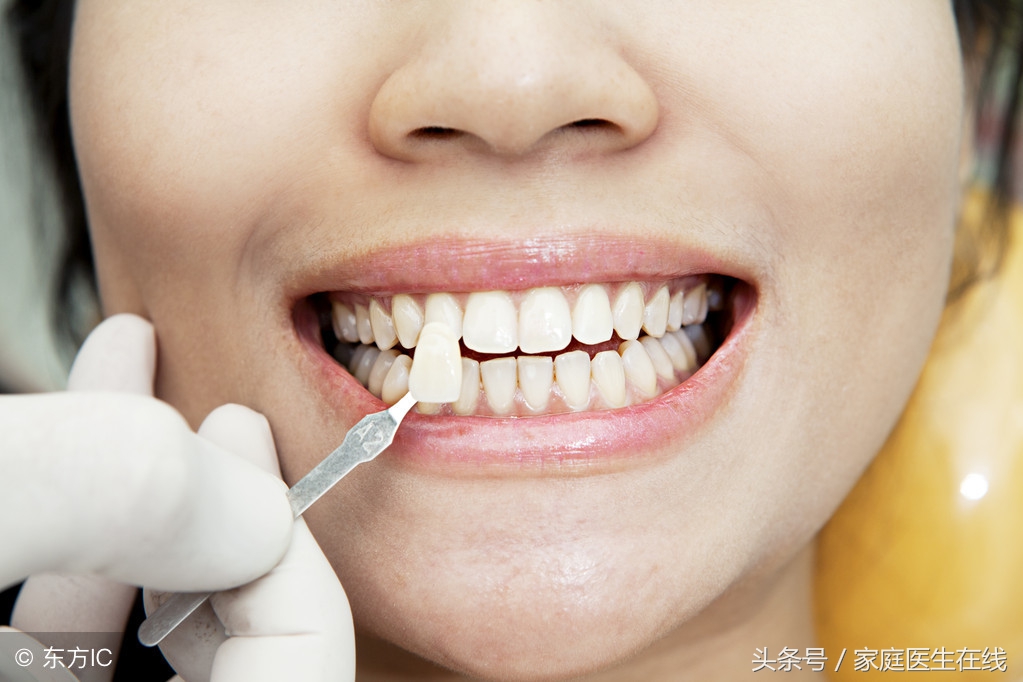 牙齿黄的人如何成功“洗白”？这两种方法，值得收藏