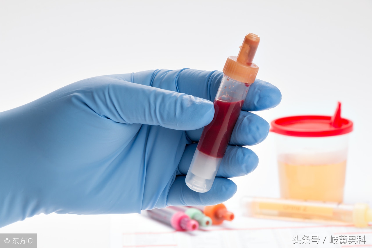 男性尿血是怎么回事？常见原因及健康警示