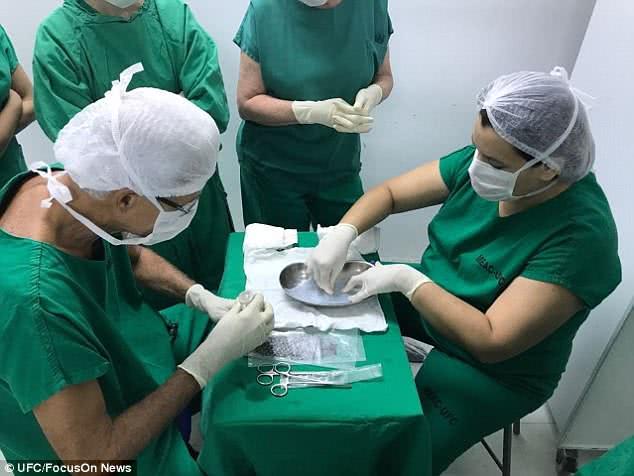 先天阴道缺失 她成为首个体验 鱼皮 重塑阴道手术 的女大学生