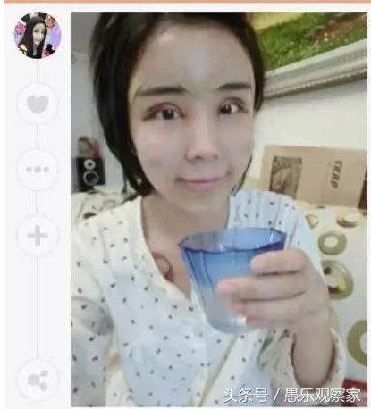 14岁就开始整容成“蛇精脸”,因炫富走红，现在又把脸整成了混血