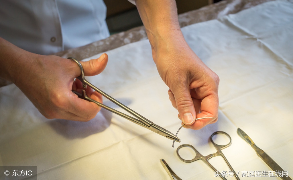 什么是男性结扎手术?男人结扎,可能会有这4个并发症