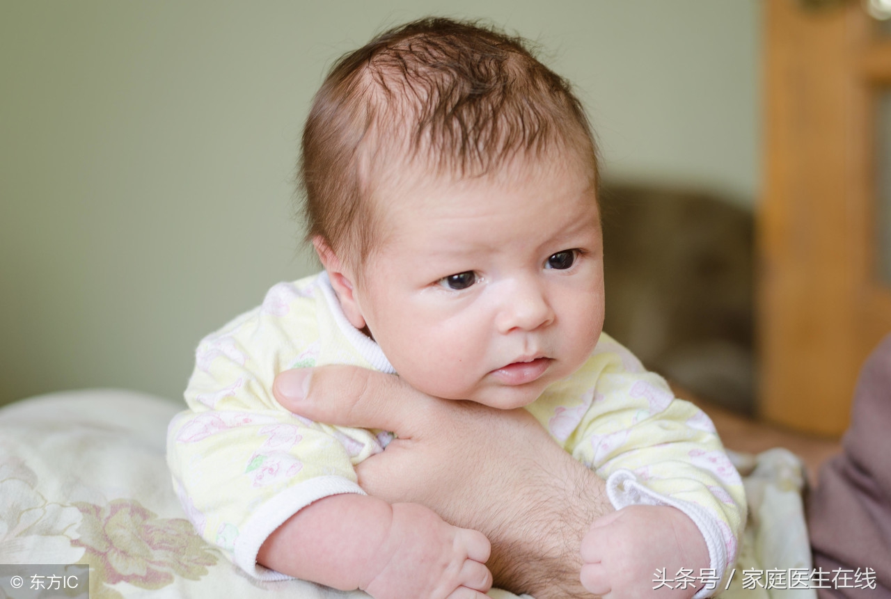 《门诊小故事》婴儿湿疹可以使用激素吗？