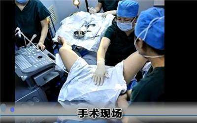 试管婴儿是怎么回事？解密试管婴儿全过程，原来这么神奇！