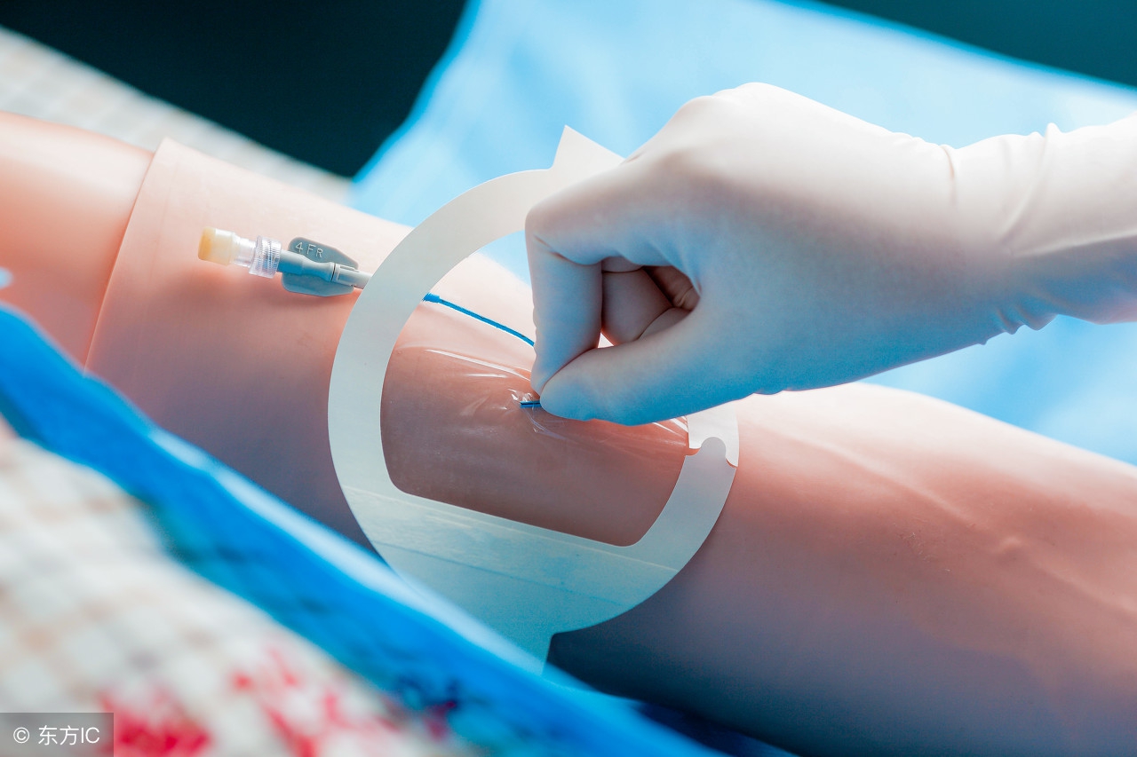 护士为什么要为病人穿刺留置针护士为什么总让用留置针