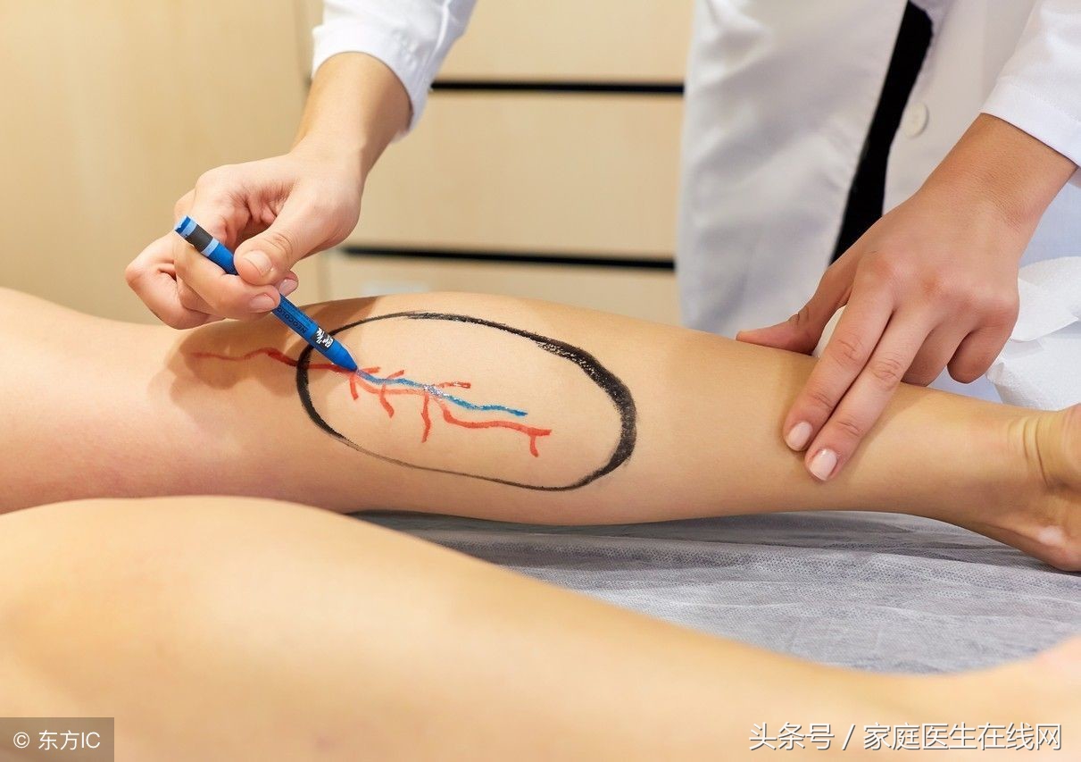 这6个部位发生动脉硬化，症状也会千差万别，对照看看