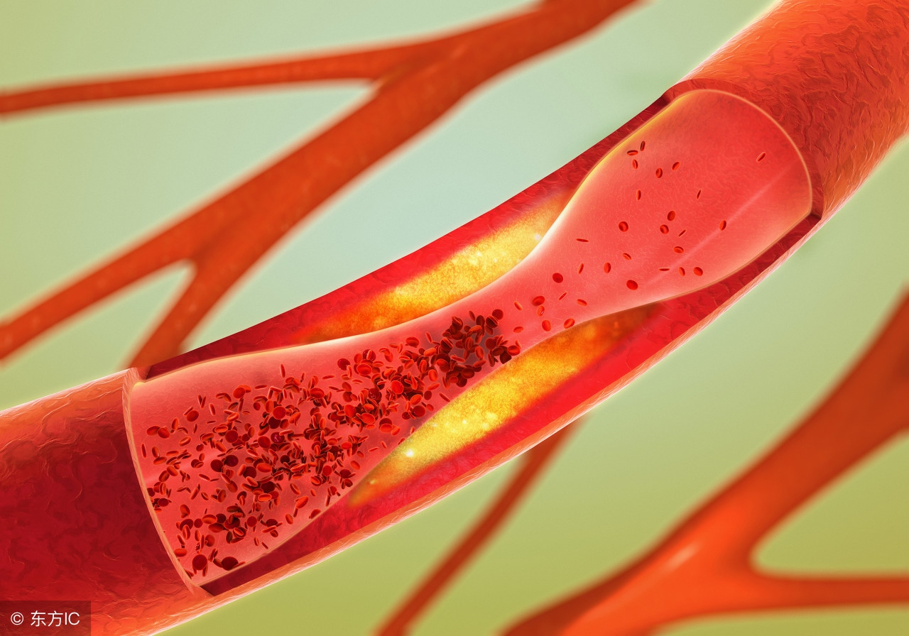 耳鸣是什么原因造成的？3个小妙招，或能让你告别耳鸣