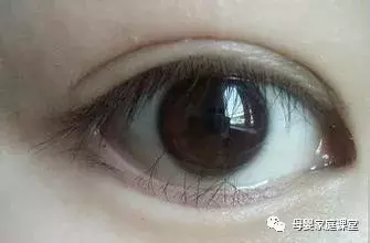 婴儿睫毛上有白色东西（宝宝突然眼屎增多）