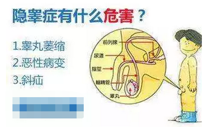 幼儿患隐睾症危害极大！腹腔镜下治疗比开放术式更具优势？