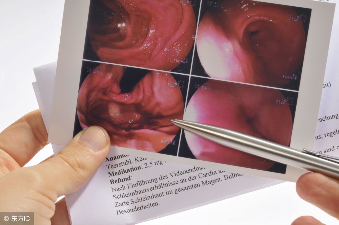 悄悄告诉你，检查幽门螺旋杆菌的方法有6种，可多了解了解