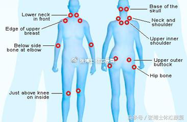 「运动康复科普」浑身肌肉总是酸痛难忍？纤维肌痛症大家了解一下