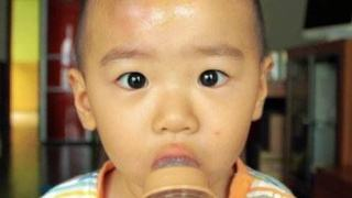 「备用！收藏！」头撞了个包？宝宝头部受伤处理方法，大人也适用