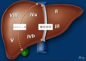 肝脏图片位置示意图(这份肝脏解剖图解，不收藏就亏了！)