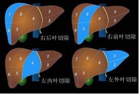 肝脏图片位置示意图(这份肝脏解剖图解，不收藏就亏了！)