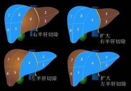 肝脏图片位置示意图(这份肝脏解剖图解，不收藏就亏了！)