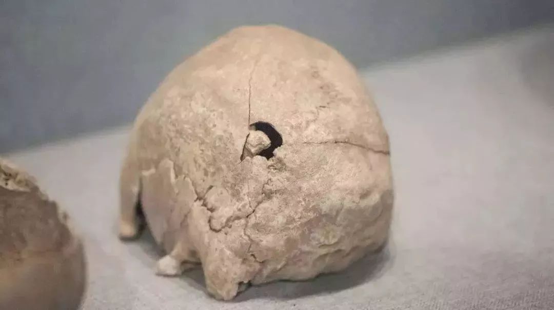 为了避邪，杀人犯在被害者脑子里种了一棵桃树