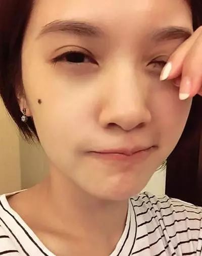 女明星脸上长痣,居然对颜值有这么大帮助