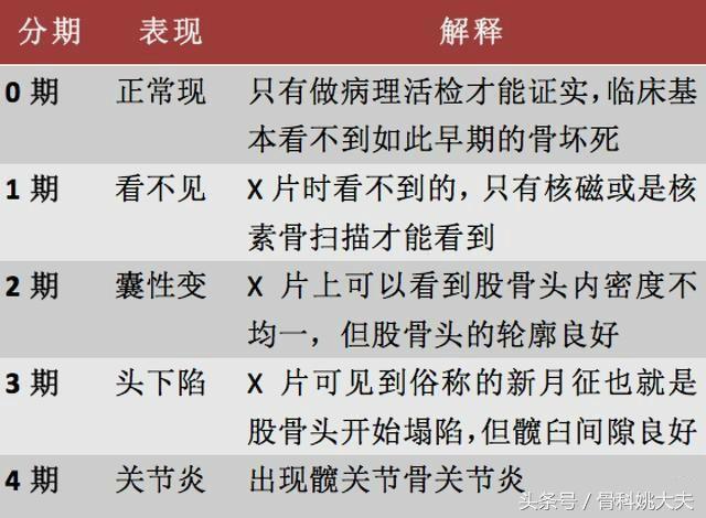 股骨头坏死应该如何治疗？医生告诉你答案！