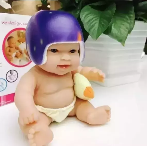 宝宝额头骨头凸起图片(宝宝偏头) - 赤虎壹号