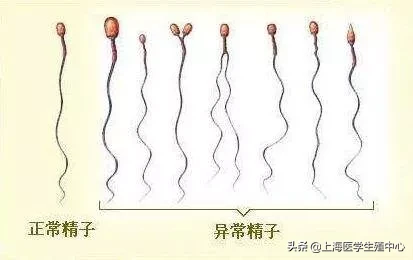 试管婴儿 | 对于不育不孕的患者,在什么情况下适合去做试管助孕?
