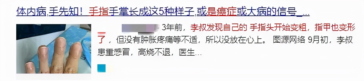 手指变粗指甲变形（手指甲严重变形是什么原因） 1