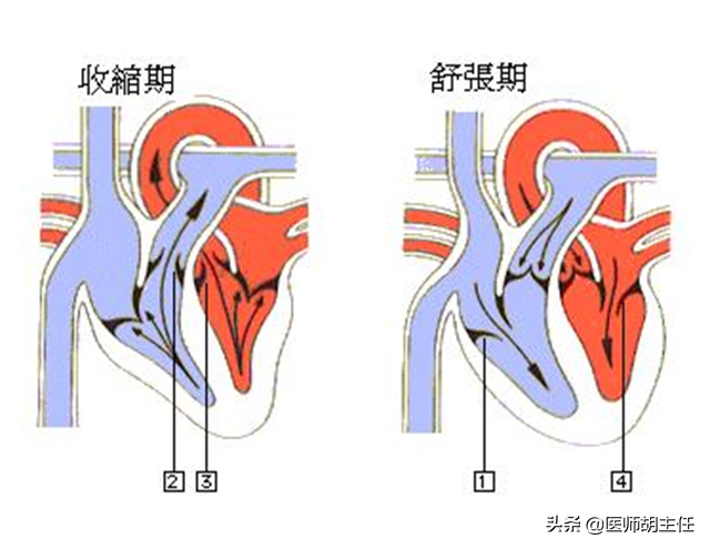 中青年人的高血压，为何高压不高，而低压高？治疗上，有何讲究？