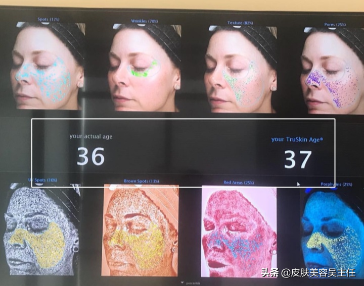 如何看待检测皮肤的visia检测结果？