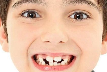 孩子的乳牙储存起来别扔，关键时候能救命？有条件没想的那么简单