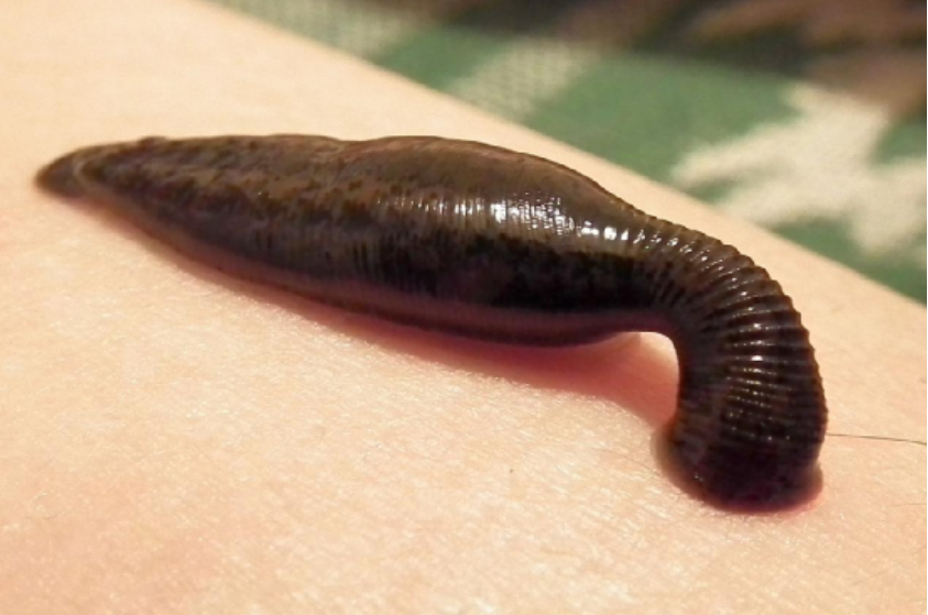 今日河南水蛭叫什么_河南水蛭疗法_云百科