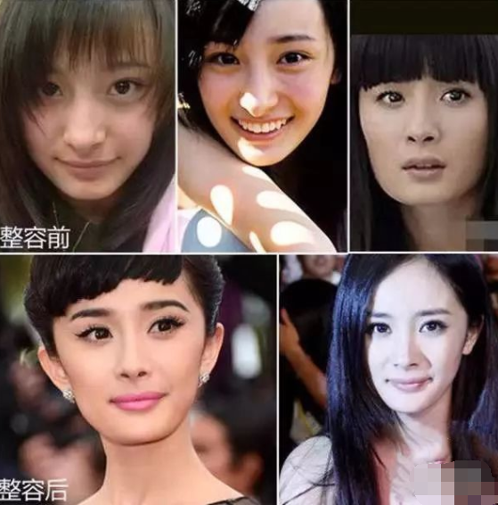 2,鹰钩鼻的美与丑