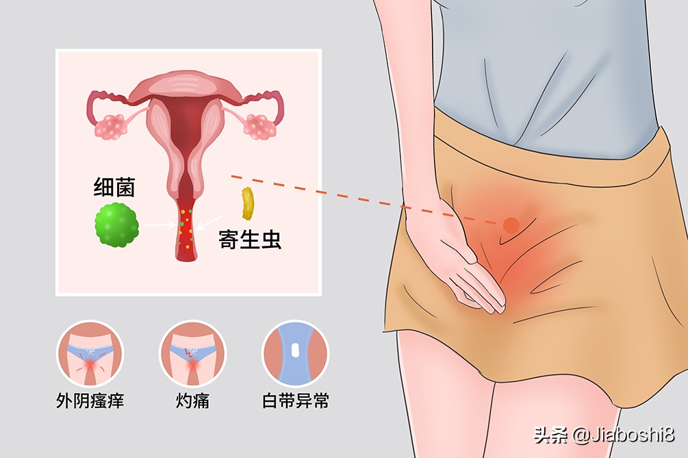妇科炎症高发？教你科学居家调理方法
