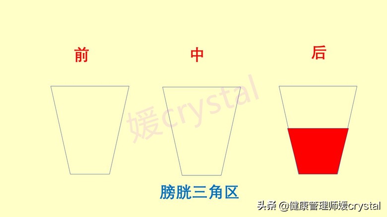 孩子尿液白色有沉淀，是不是健康有问题？4个方法判别