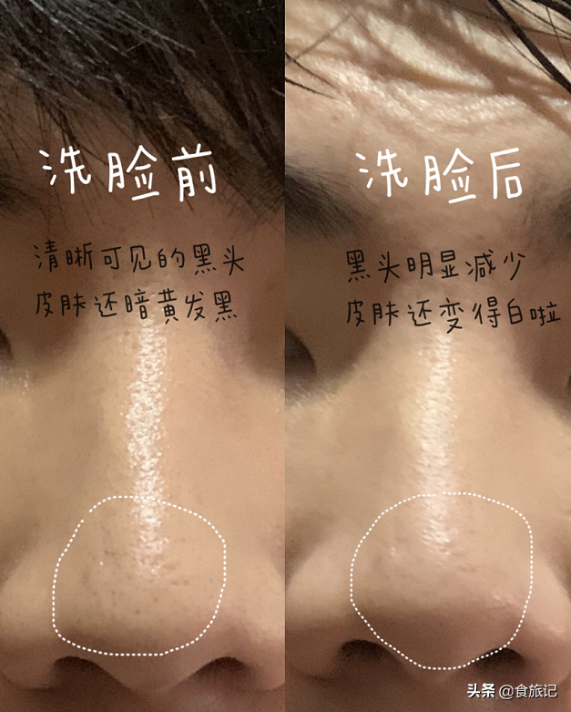 真情永不变，大宝天天见！80后90后，第一支护肤品绝对是它