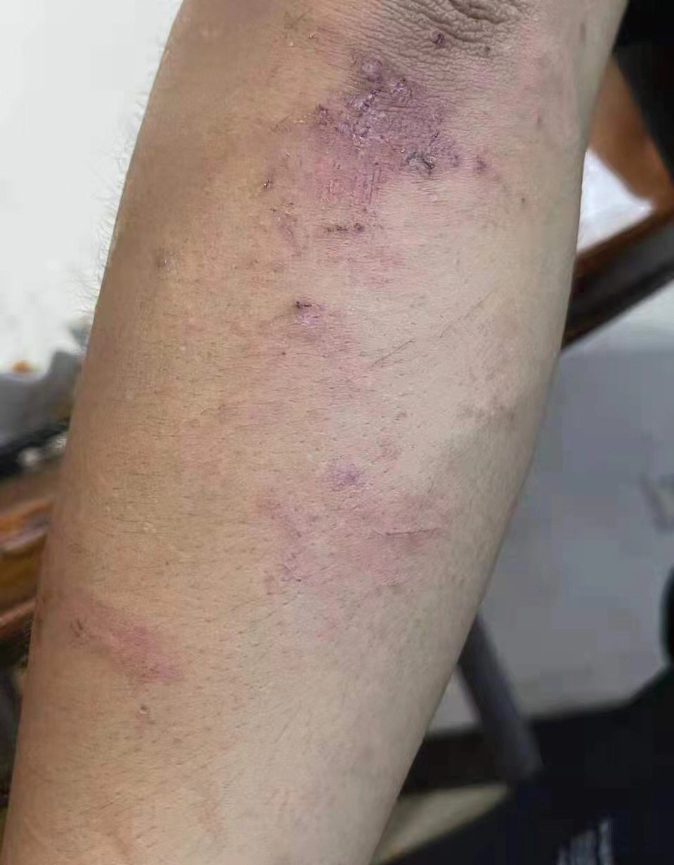 网曝刘宇宁新剧场务打人，三人围攻拳打脚踢，还放狠话：有钱不怕