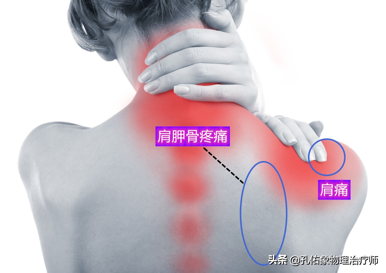 后背,肩胛骨内侧缘疼痛,是怎么回事?该如何处理?给您讲清楚
