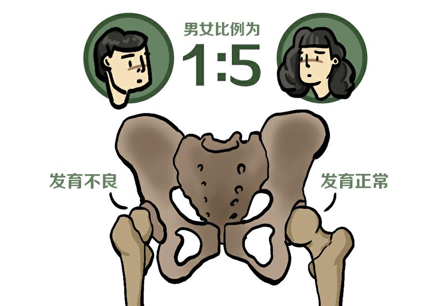 40%-60%到中年出现髋关节痛