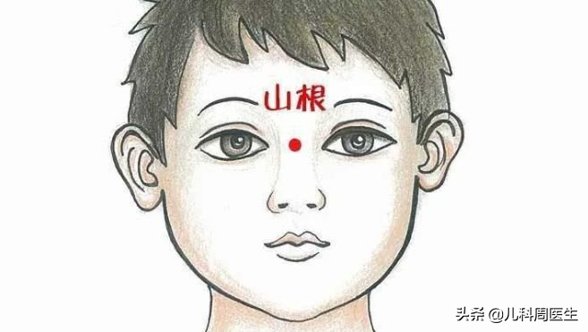 婴儿鼻尖一条竖线图片(孩子鼻梁上的) - 赤虎壹号