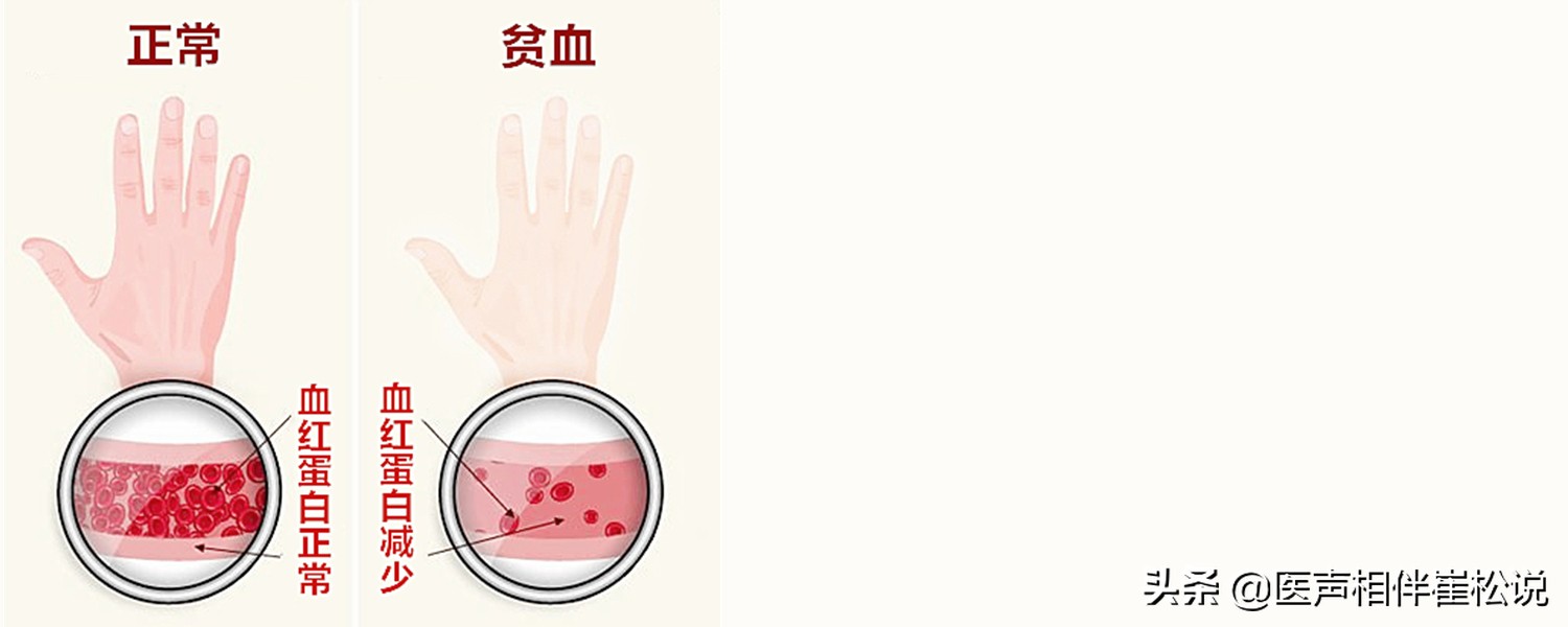 心电图上的T波改变严重吗？！是不是心肌缺血？！