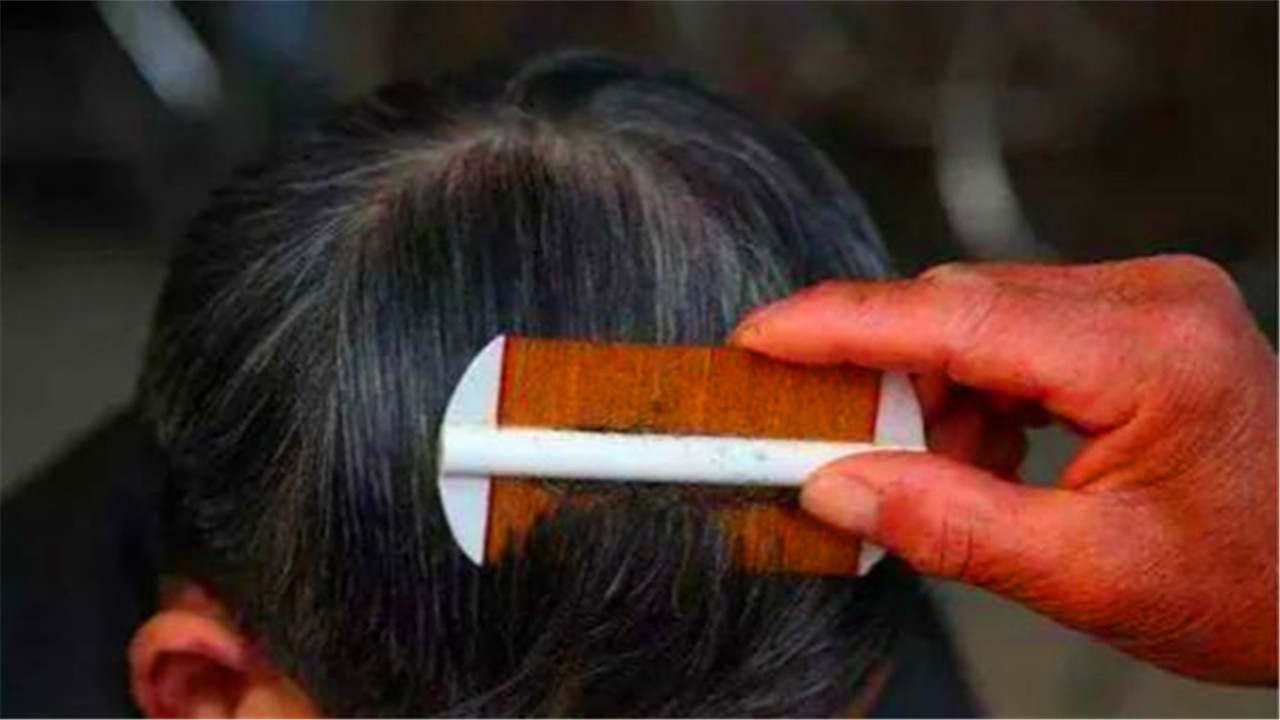 同人类共进化，30年前农村人人都长的虱子，为何如今看不到了？