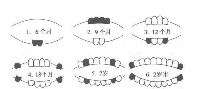 宝宝出生自带“鬼牙”，怎么办？6个宝宝长牙问题，父母需知