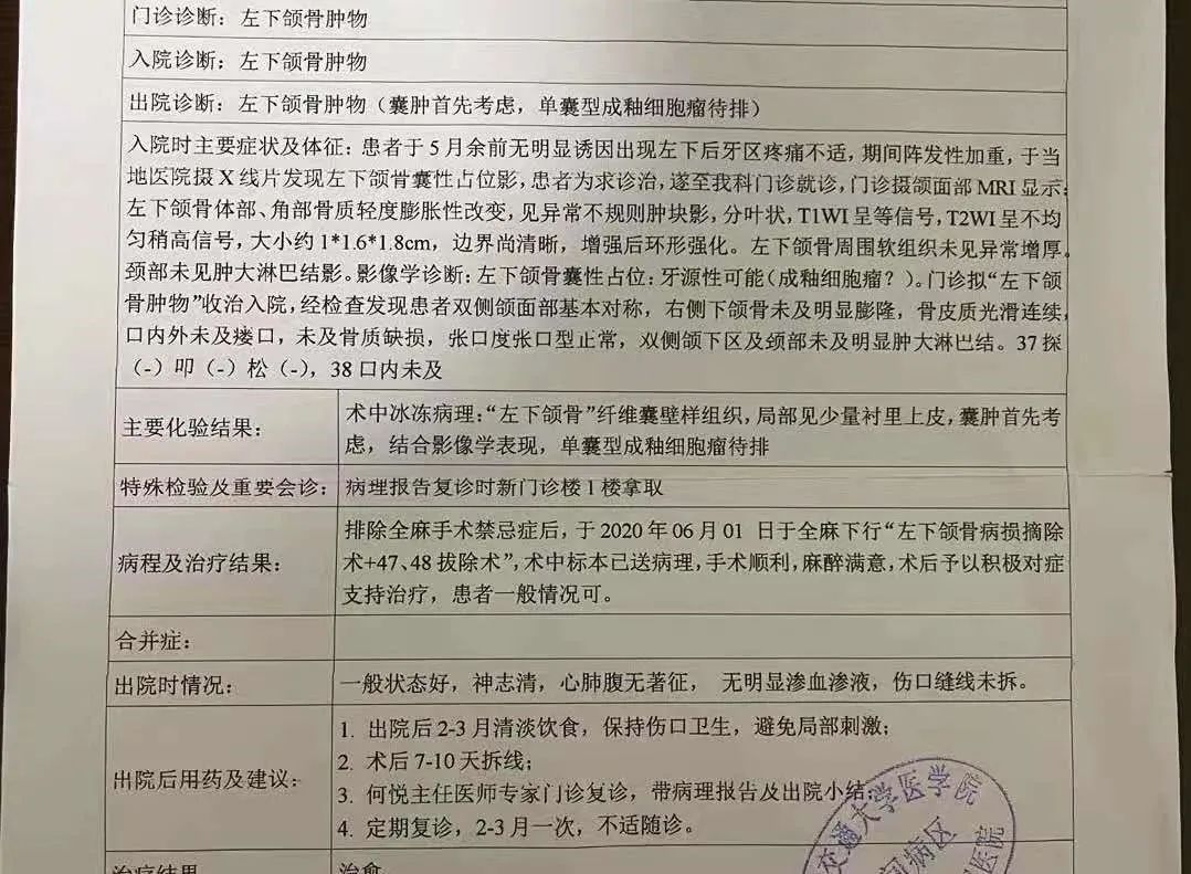 下颌骨上有个“大洞”，手术前我专门去吃了火锅