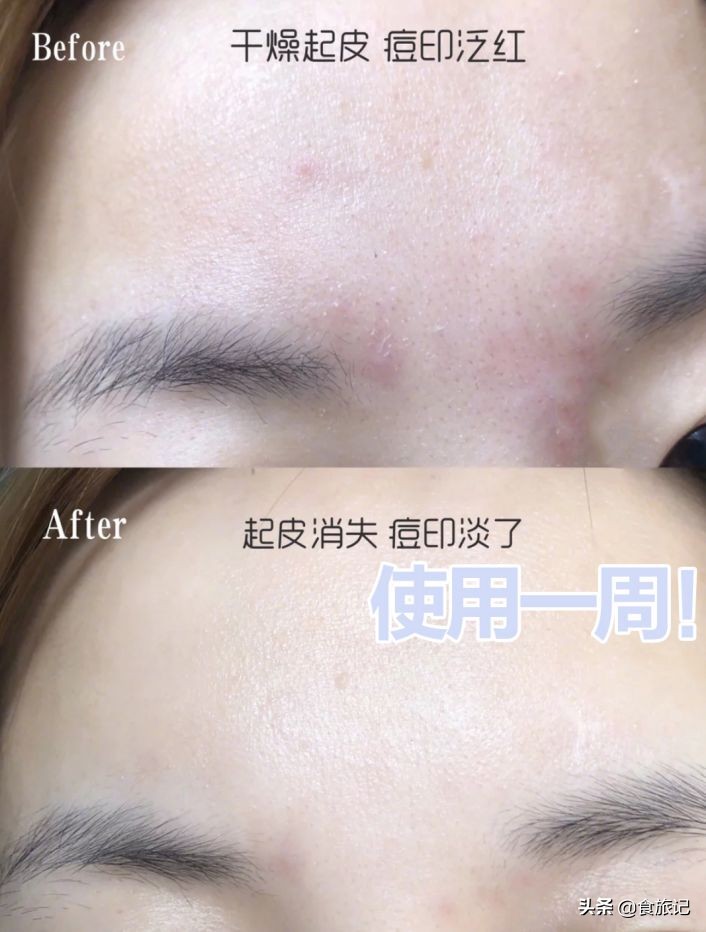 真情永不变，大宝天天见！80后90后，第一支护肤品绝对是它