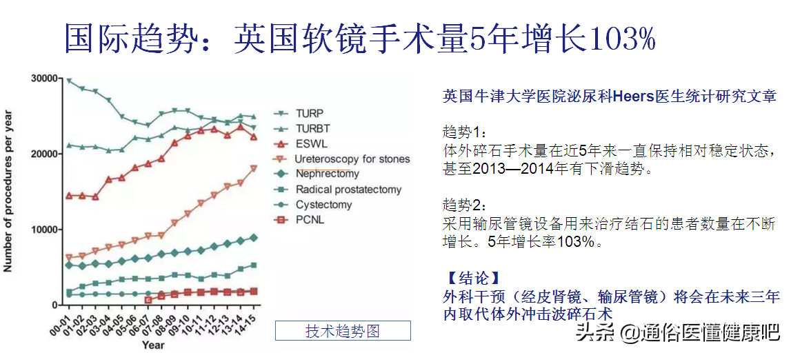 体外冲击波“碎石”和输尿管软镜“取石”，谁更“胜”一筹？