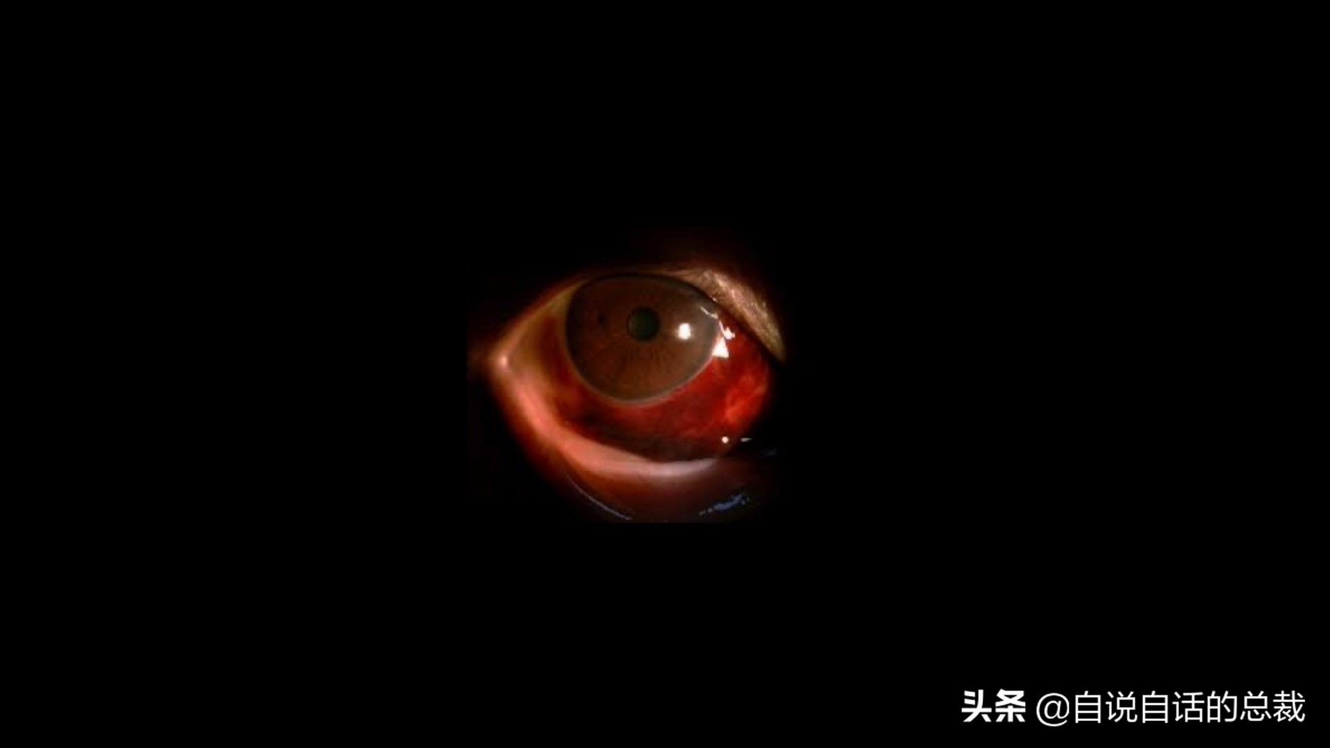 埃博拉：人类的诅咒，你的身体如何对抗它，它到底有多恐怖