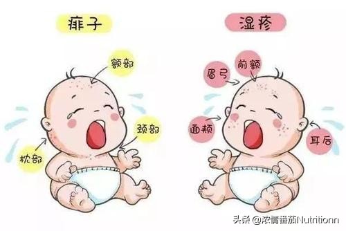 婴儿阴囊湿疹图片(夏季如何分辨宝宝湿疹和痱子) 