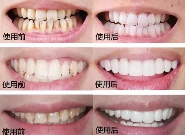 为什么口臭的人自己闻不到？教你正确做法，呼吸都是“甜”的