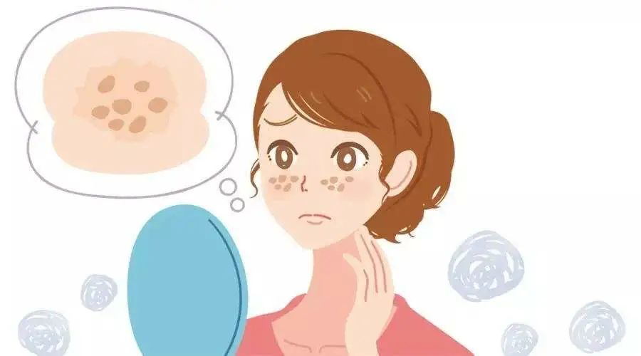 黄褐斑,长在脸的两侧皮肤,主要是黄褐色的,甚至带有一点粉红色,散在在